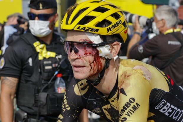Sepp Kuss after his Tour de France stage 20 crash