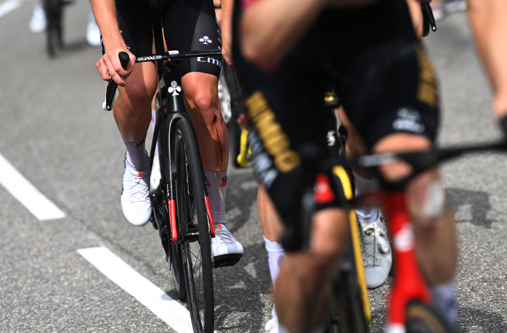 COURCHEVEL FRANCE 19 JUILLET Vue détaillée d'une blessure de Tadej Pogacar de Slovénie et UAE Team Emirates White Best Young Rider Jersey lors de la dix-septième étape du 110e Tour de France 2023 a 1657km au stade de SaintGervais MontBlanc à Courchevel UCIWT le 19 juillet 2023 à Courchevel Photo France par Tim de WaeleGetty Images