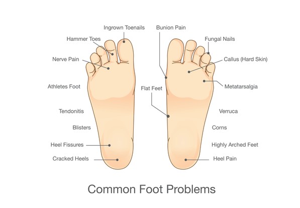 Vous avez mal aux pieds à vélo ? Causes courantes et solutions ...