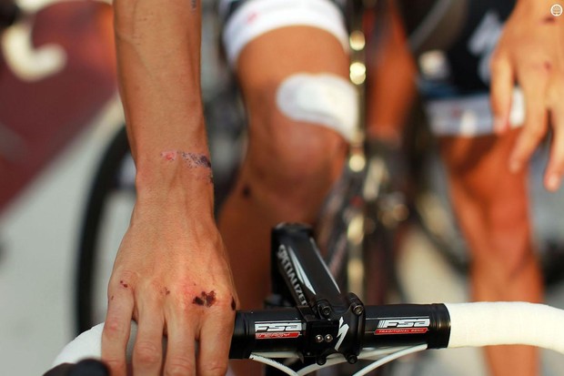 5 conseils pour traiter une plaie de vélo