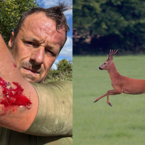 Steve's injuries (left) and his image of a deer